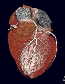 Cardiac CT - MHVI
